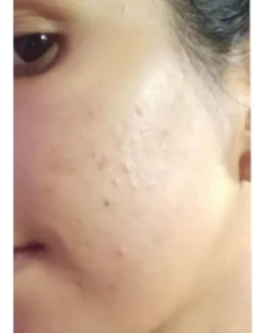 Customer after photo