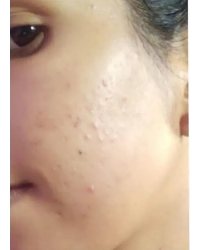 Customer after photo