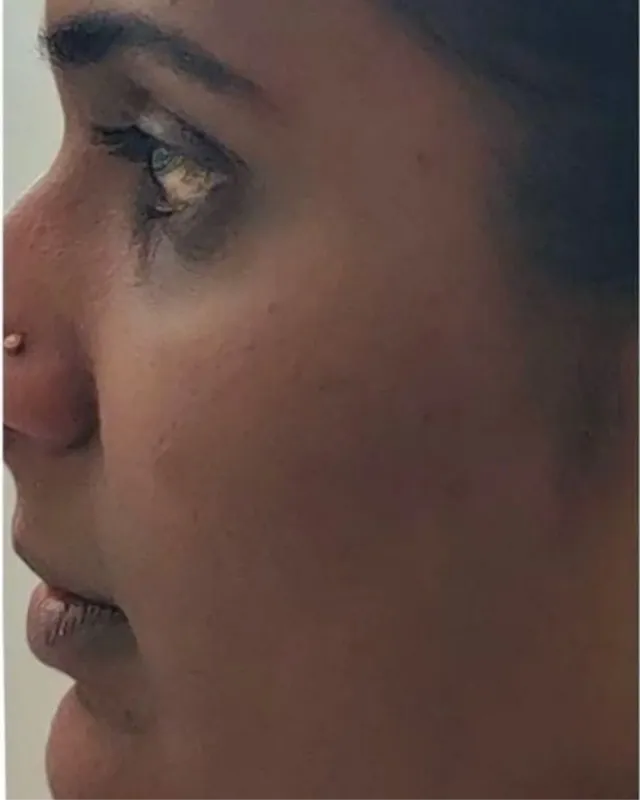 Customer before photo